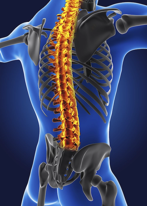 Coluna e Spine - Cirurgia de coluna vertebral